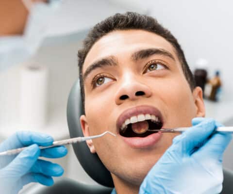 Composite Dental Fillings